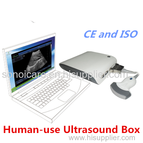 Aniaml sonography ubox/Magic Ultrasound BOX Scanner/USG BOX/ Echo sonography/ CE ultrasonic machine/high-tech usg