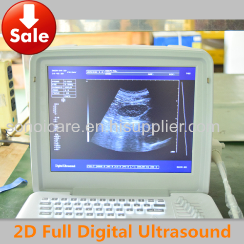Best-selling 12LED Portable Scanner/USG machine/ Echo sonography/ CE ultrasonic machine/high-tech usg
