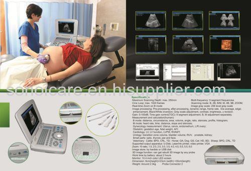 CE-approved Notebook Ultrasound Scanner/USG Machine/Echo sonography/44 pseudocolor Ultrasonic Device/Ultras sound Device