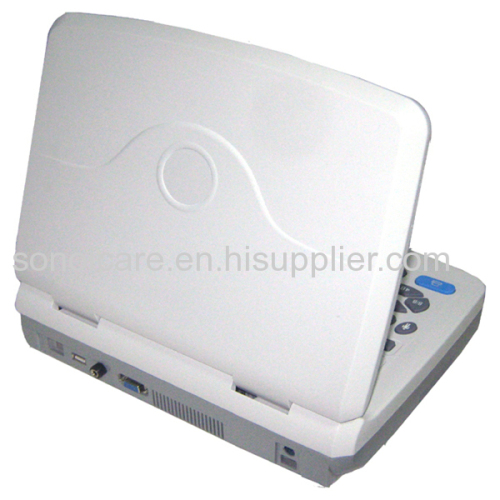 CE approved VET Notebook Ultrasound Scanner/USG Machine/Echo sonography/44 color Ultrasonic Device/Ultrasound Device 