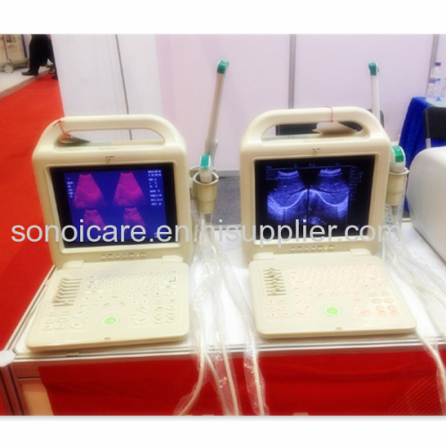 Aniaml sonography/Magic Ultrasound Scanner/USG Scanner/ Echo sonography/ CE ultrasonic machine/high-tech usg 