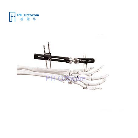 China Manufacturer Orthopedic Instrument Ao External Fixtors Tibia