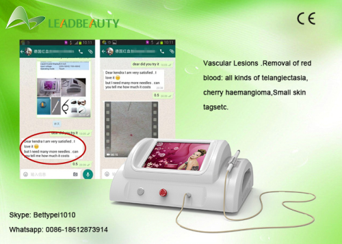 30MHz RBS high frequency portable vein / vascular spider vein removal machine