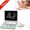 CE approved Notebook Ultrasound Scanner/USG Machine/Echo sonography/15inch Ultra sound Device