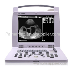 Full Digital Veterinary Portable Ultrasound Scanner