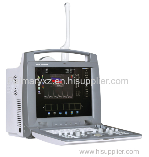 Portable 3D Color Doppler