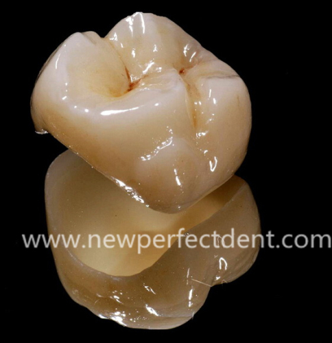 Dental lab Zirconia porcelain denture