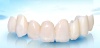 porcelain teeth porcelain material teeth