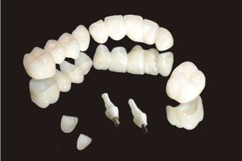 Implant Porcelain Teeth Dental Porcelain Teeth
