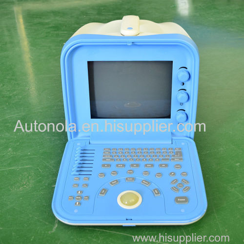 factory price Autonola portable veterinary ultrasound equipment