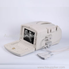 Ultrasound Machine portable Ultrasound Scanner with multi frequency probe for hospital clinics