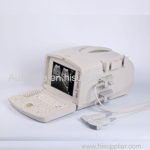 Ultrasound Machine portable Ultrasound Scanner with multi frequency probe for hospital clinics