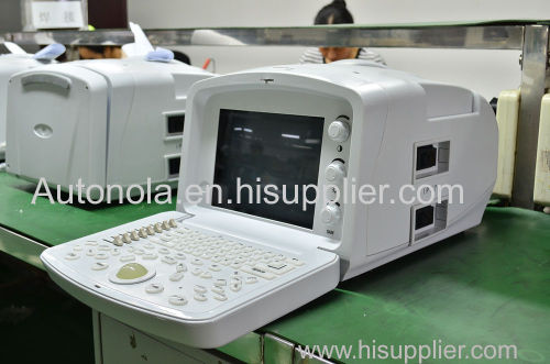 2d portable ultrasound machine price portable /veterinary ultrasound equipment