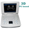 Notebook full digital windows ultrasound scanner