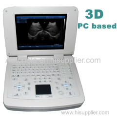 Notebook full digital windows ultrasound scanner