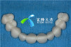 Temporary provisionals/Transition crowns/ bridges or dentures