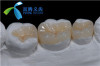 Composite/Resin restorations for Crown/Bridge/Onlay/Inlay/veneers from Shofu