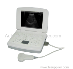 Full digital laptop veterinary diagnostic system ultrasound scanner with factory price