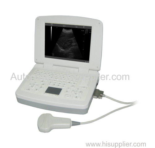 Full digital laptop veterinary diagnostic system ultrasound scanner with factory price