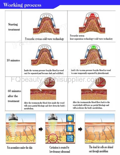 FQA19 Cryolipolysis lipo laser slimming machine