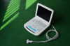 ATNL-6801 Portable and convenient Full-digital Notebook Color Doppler System