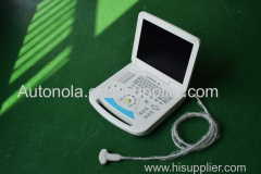 ATNL-6801 Portable and convenient Full-digital Notebook Color Doppler System