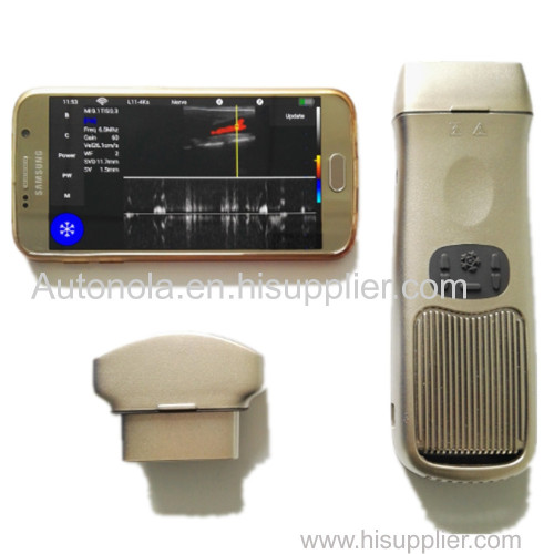 Wireless black and white pocket ultrasound probe ATNL 40C