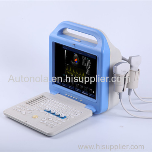 Patient Monitor 12 inches LCD monitor Laptop Color Doppler Ultrasound Scanner