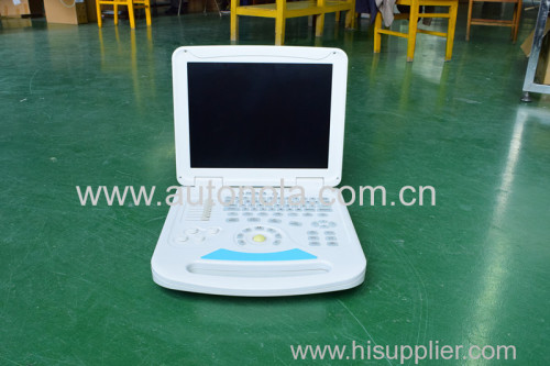 80 elements Full Digital Notebook Color Doppler ATNL6800