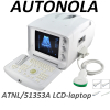 China Autonola Medical full digital Ultrasound Diagnostic System portable powerful ultrasound machine