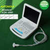 Fulldigital Great Quality Notebook Human Color Doppler System for Clinic Hospital More Probe Options