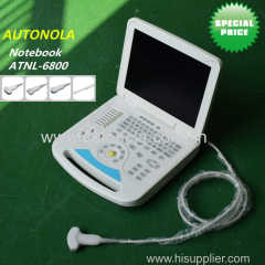 2017 Hot Sale Full-digital Human Notebook Color Doppler System for Hospital Clinic