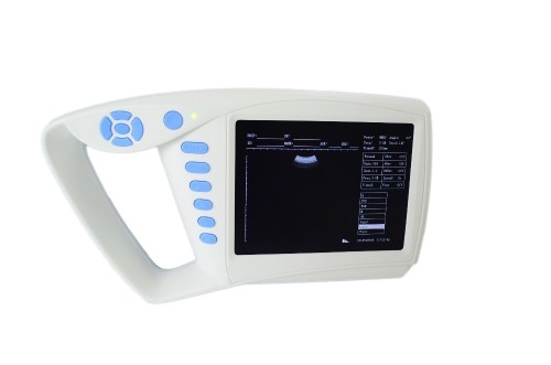 Full Digital Palm Ultrasound Scanner Good quality Accurate measurement Probe automatic identification for human