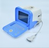 Portable Ultrasound Equipment B/W Ultrasound Scanner vet Ultrasound