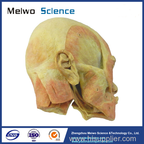 Superficial muscle of masticatory specimen for medical university