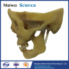 temporal-mandibular joint plastinated specimen for medical university