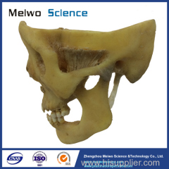 temporal-mandibular joint plastinated specimen for medical university