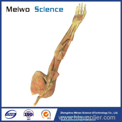 Middle muscle of human upper limb specimen plastination
