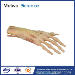 Superficial muscles of hand plastination specimen