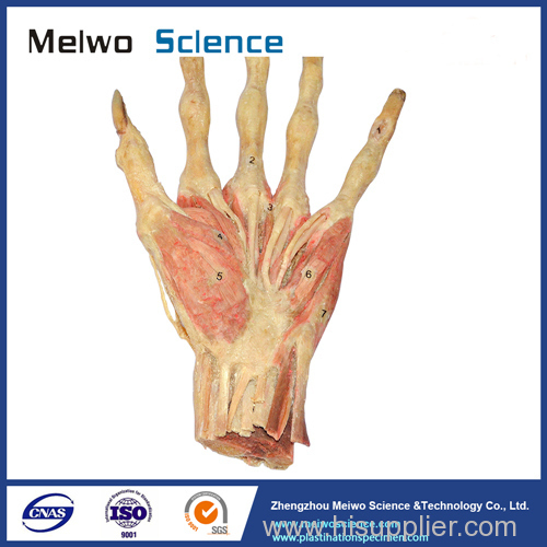 Middle muscle of human hand plastinated specimen