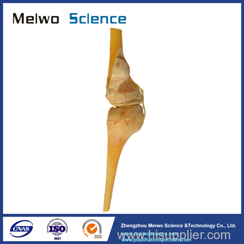 Saggital section of human knee joint plastinated specimen