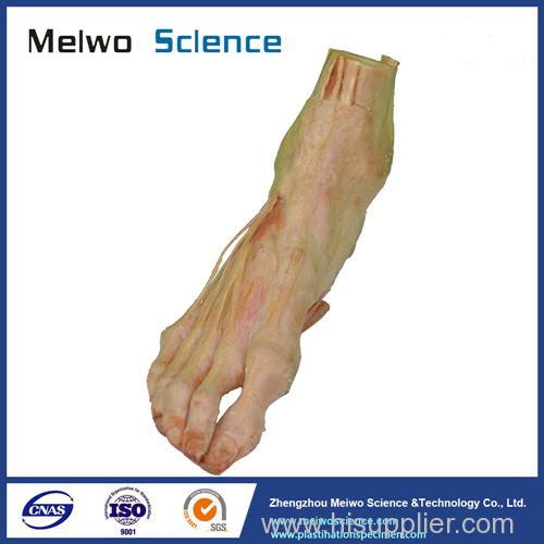 Superficial muscle of foot plastinated specimen