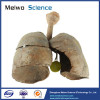 Child lung and larynx medical specimen plastination