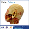 External carotid artery plastinated specimen for medical university