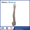 Upper limb artery plastination specimen