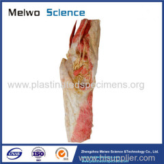 Human lumbosacral plexus in situ plastinated specimen