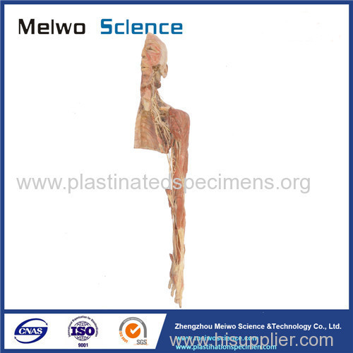 Brachial plexus and its branches plastinated specimen