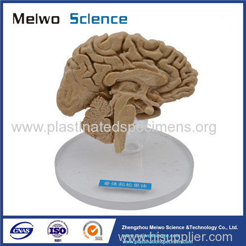 Human pituitary and pineal gland plastinated specimen