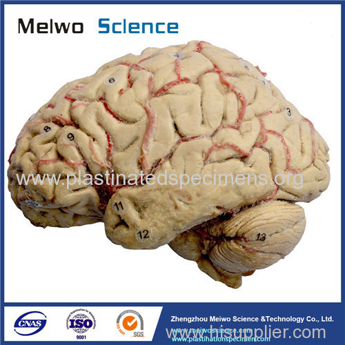Cerebral hemisphere and brain stem plastinated specimen