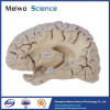 Hippocampal formation plastination for medical university